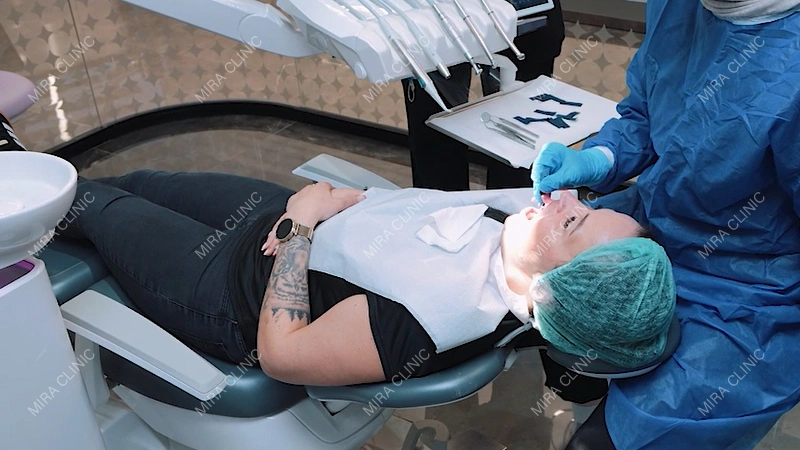 Full Treatment: 6 Implants and 24 Crowns